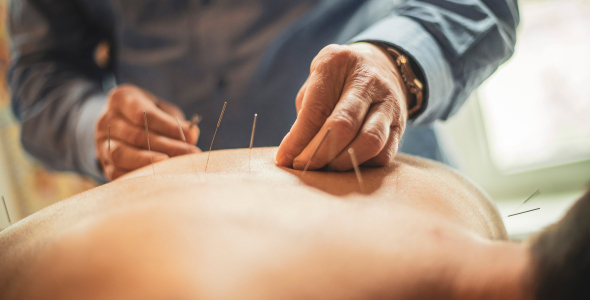 A person receiving acupuncture therapy