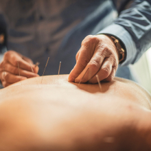 A person receiving acupuncture therapy